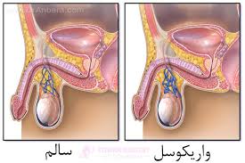 معجون واریکوسل وارداتی/طب سنتی هندی ایرانی ترکیب 16 گیاه +20گرم ژل رویال گرید a
